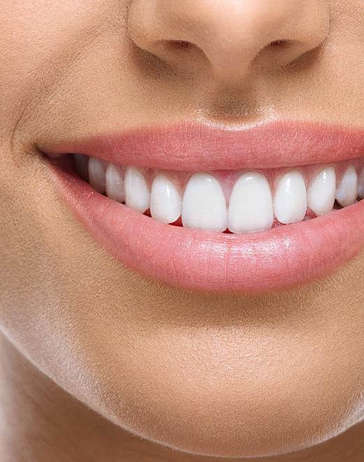 Les aspects traités en dentisterie esthétique